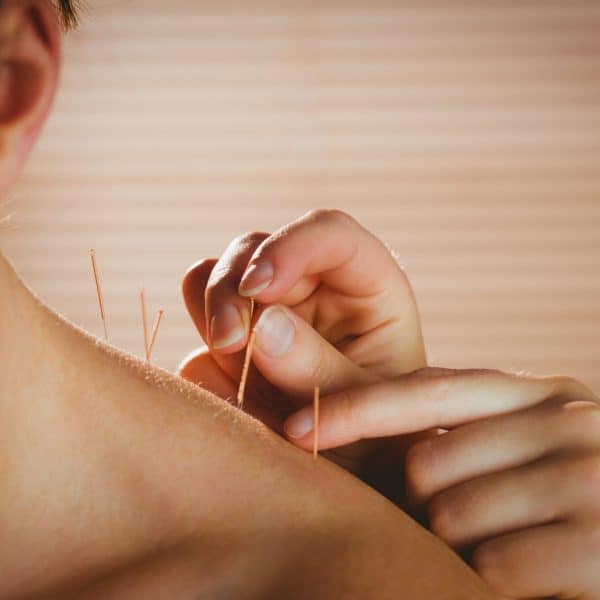 Acupuncture Healing for Better Wellness